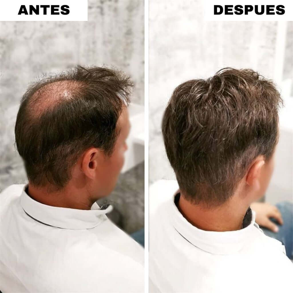 RELLENO CAPILAR INSTANTANEO