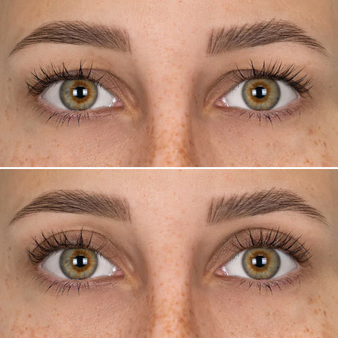 MiradaNova™️ realza tus parpados caídos y rejuvenece tu mirada 👁️👁️
