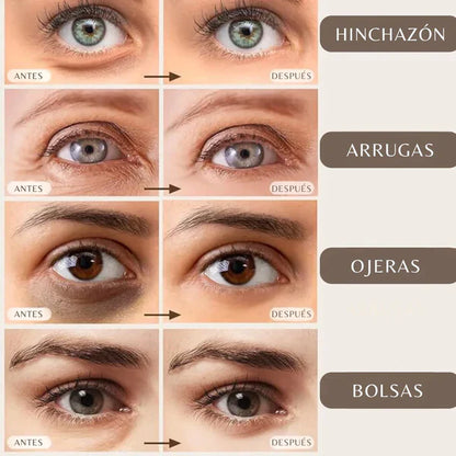 Parches de Ojos Anti-Aging con Ácido Hialurónico