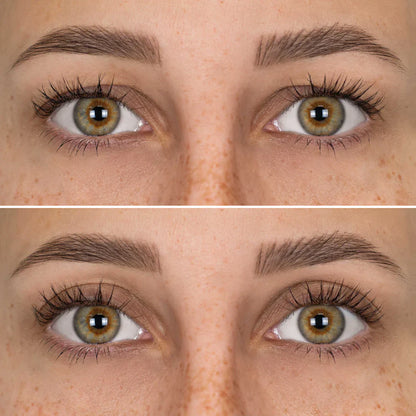 MiradaNova™️ realza tus parpados caídos y rejuvenece tu mirada 👁️👁️